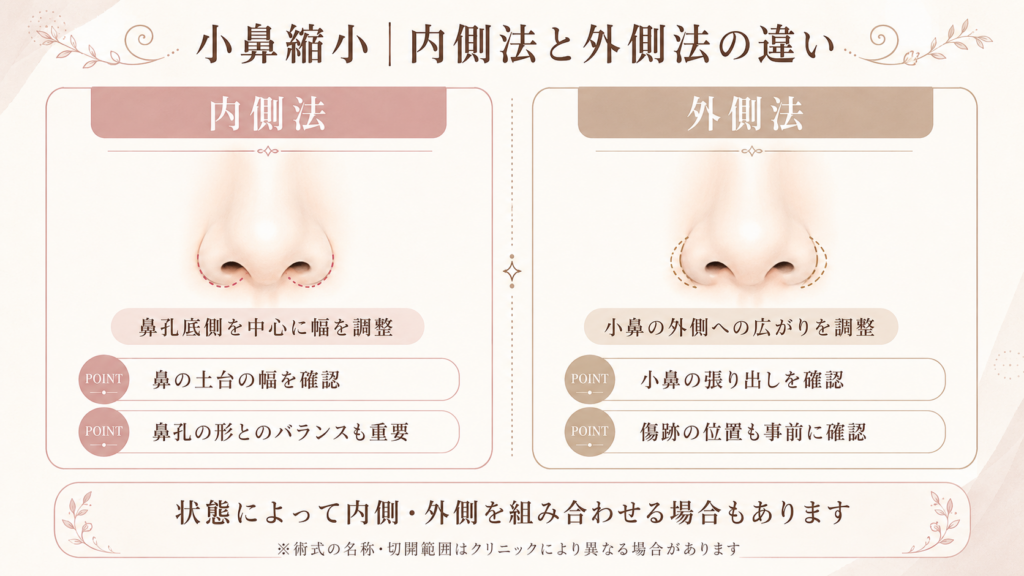 小鼻縮小の内側法と外側法の違い