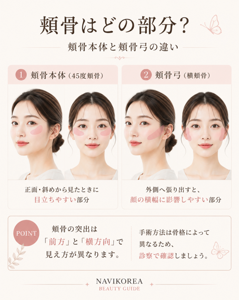 頬骨本体と頬骨弓の違いをわかりやすく解説
